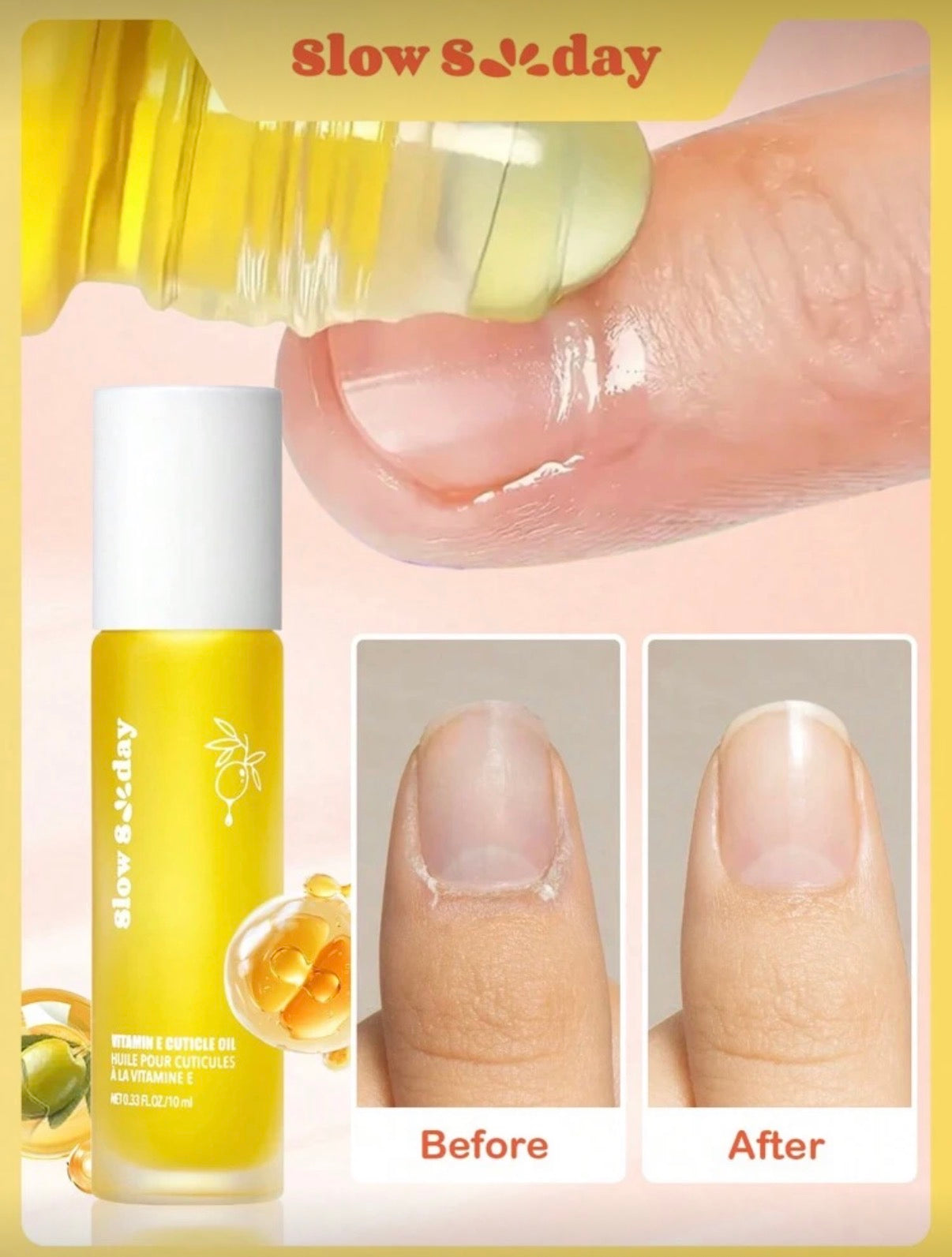 فتامين للأظافر