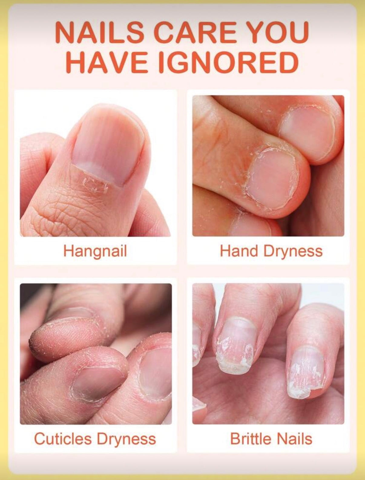 فتامين للأظافر