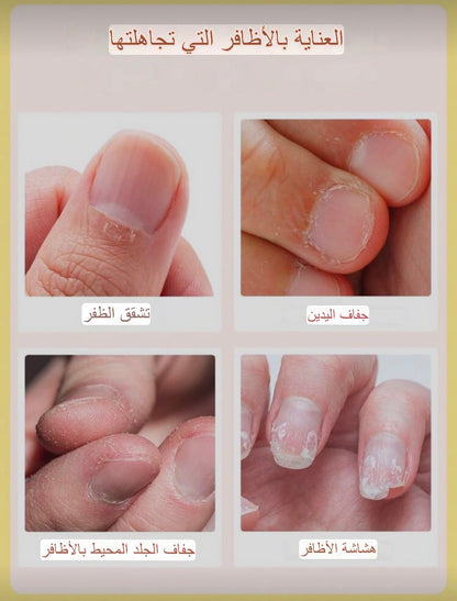 فتامين للأظافر